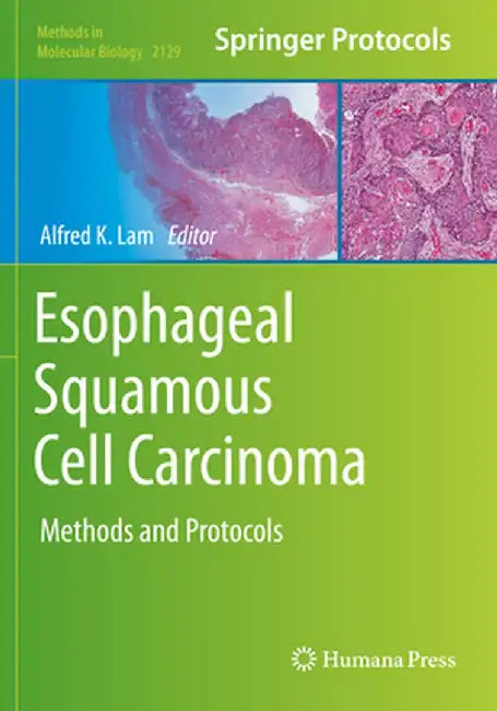 Esophageal Squamous Cell Carcinoma: Methods and Protocols by Alfred K. Lam