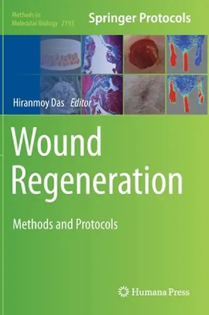 Wound Regeneration: Methods and Protocols by Hiranmoy Das