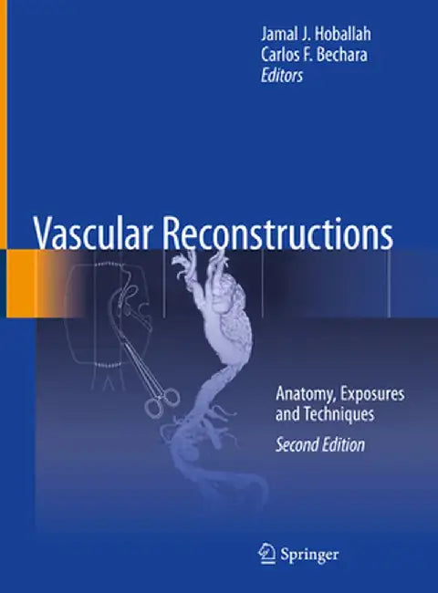 Vascular Reconstructions: Anatomy, Exposures and Techniques by Jamal J. Hoballah