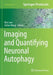 Imaging and Quantifying Neuronal Autophagy by Ben Loos