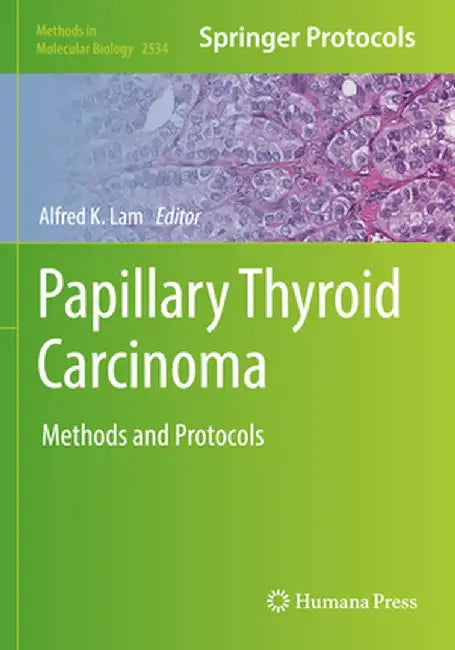 Papillary Thyroid Carcinoma: Methods and Protocols by Alfred K. Lam