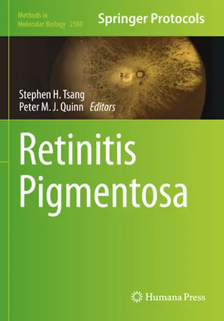 Retinitis Pigmentosa by Stephen H. Tsang
