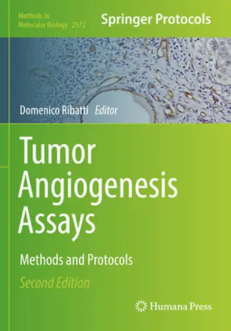 Tumor Angiogenesis Assays: Methods and Protocols by Domenico Ribatti