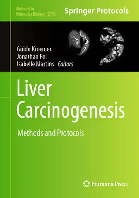 Liver Carcinogenesis: Methods and Protocols by Guido Kroemer