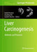 Liver Carcinogenesis: Methods and Protocols by Guido Kroemer