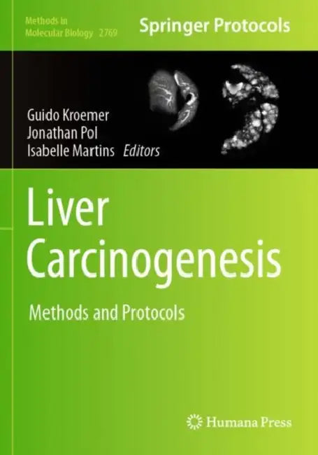 Liver Carcinogenesis: Methods and Protocols by Guido Kroemer