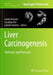 Liver Carcinogenesis: Methods and Protocols by Guido Kroemer