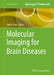Molecular Imaging for Brain Diseases by Daichi Sone