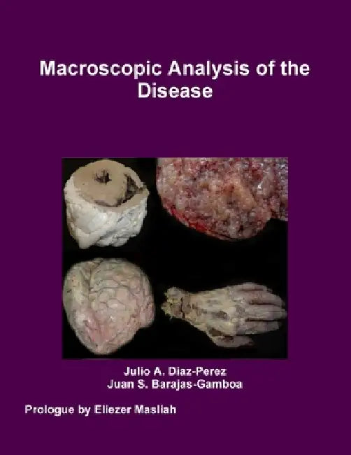 Macroscopic Analysis of the Disease by Julio Diaz-Perez, Juan Barajas-Gamboa