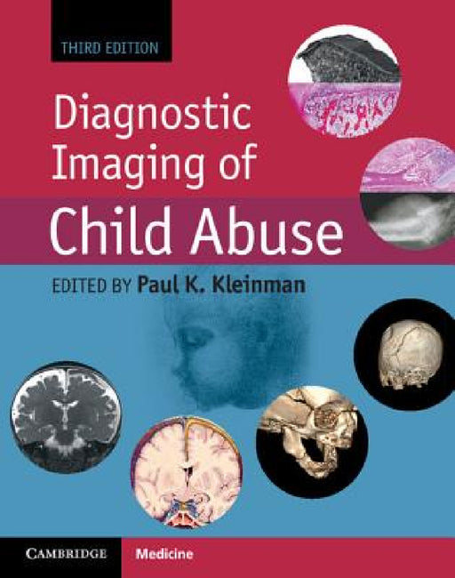 Diagnostic Imaging of Child Abuse by Paul K. Kleinman