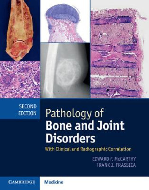 Pathology of Bone and Joint Disorders Print and Online Bundle: With Clinical and Radiographic Correlation by Edward F. McCarthy, Frank J. Frassica