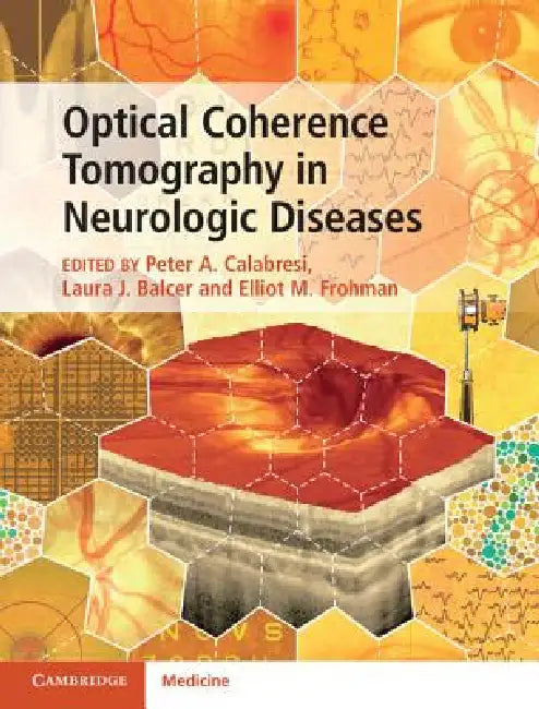 Optical Coherence Tomography in Neurologic Diseases by Peter A. Calabresi, Laura J. Balcer, Elliot M. Frohman