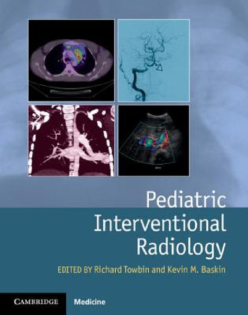 Pediatric Interventional Radiology by Richard Towbin, Kevin Baskin
