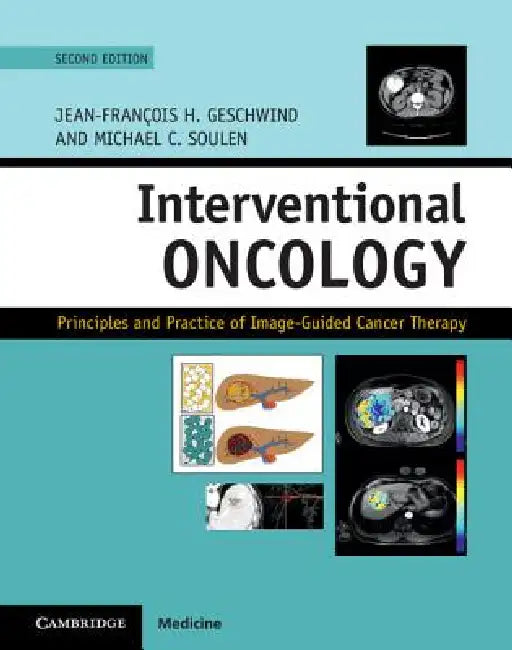 Interventional Oncology: Principles and Practice of Image-Guided Cancer Therapy by Jean-Francois H. Geschwind, Michael C. Soulen