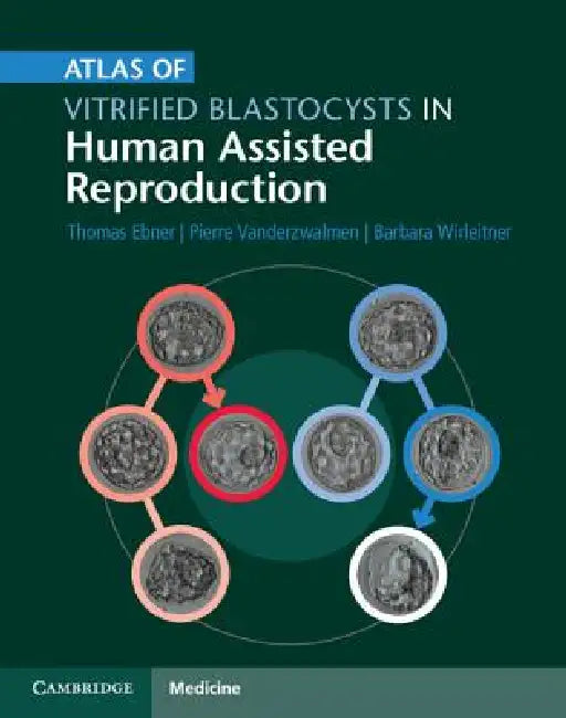 Atlas of Vitrified Blastocysts in Human Assisted Reproduction by Thomas Ebner, Pierre Vanderzwalmen, Barbara Wirleitner