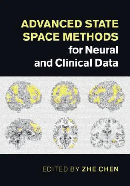 Advanced State Space Methods for Neural and Clinical Data by Zhe Chen