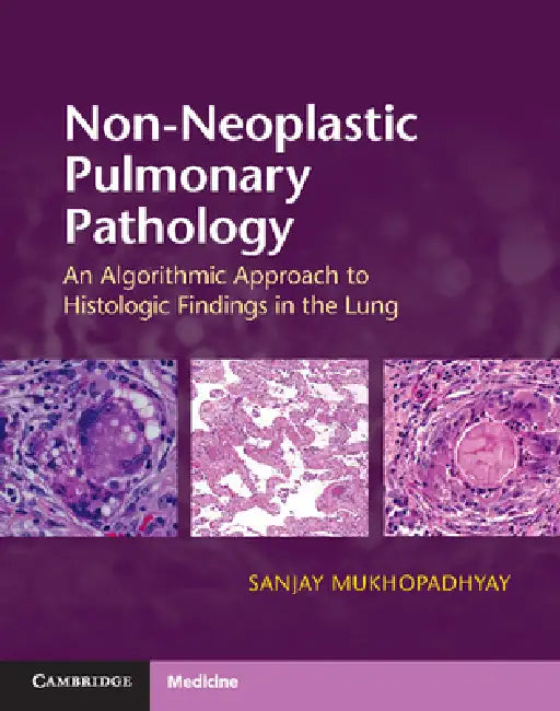 Non-Neoplastic Pulmonary Pathology with Online Resource: An Algorithmic Approach to Histologic Findings in the Lung by Sanjay Mukhopadhyay