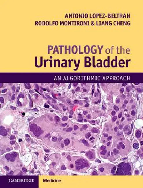 Pathology of the Urinary Bladder: An Algorithmic Approach by Antonio Lopez-Beltran, Rodolfo Montironi, Liang Cheng