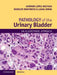 Pathology of the Urinary Bladder: An Algorithmic Approach by Antonio Lopez-Beltran, Rodolfo Montironi, Liang Cheng
