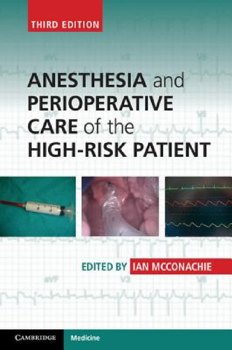 Anesthesia and Perioperative Care of the High-Risk Patient by Ian McConachie