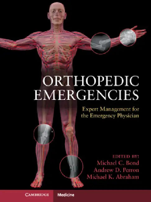 Orthopedic Emergencies: Expert Management for the Emergency Physician by Michael C. Bond, Andrew D. Perron, Michael K. Abraham