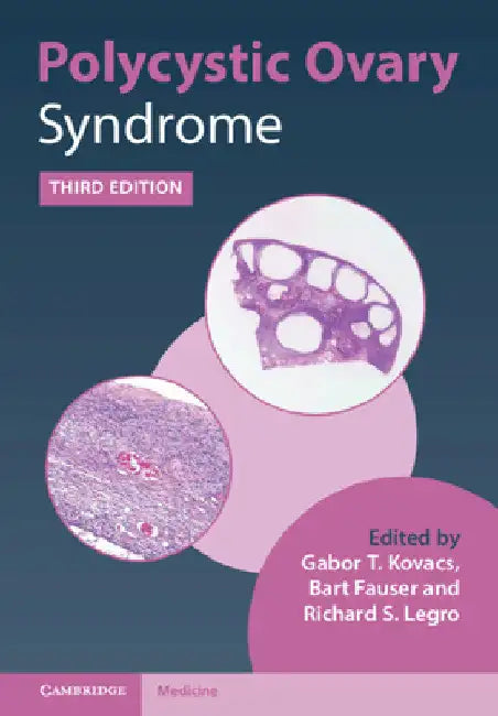 Polycystic Ovary Syndrome by Gabor T. Kovacs