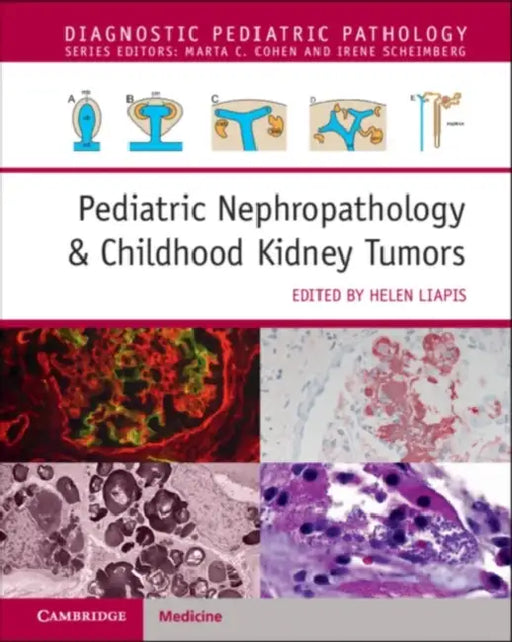 Pediatric Nephropathology & Childhood Kidney Tumors with Online Resource by Helen Liapis