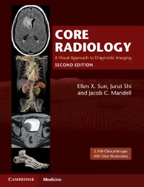 Core Radiology by Ellen X. Sun
