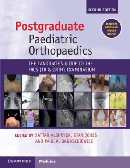 Postgraduate Paediatric Orthopaedics: The Candidate's Guide to the Frcs(tr&orth) Examination by Sattar Alshryda