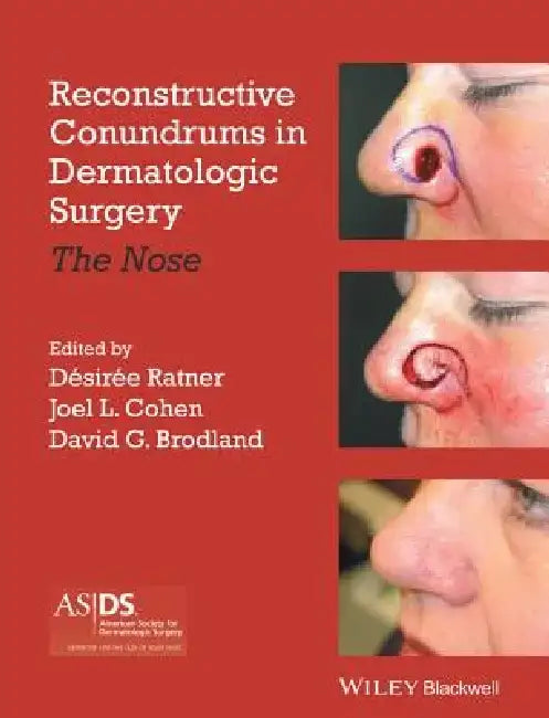 Reconstructive Conundrums in Dermatologic Surgery: The Nose by Desiree S. Ratner
