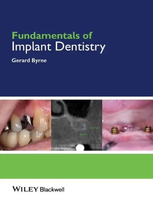 Fundamentals of Implant Dentistry by Gerard Byrne