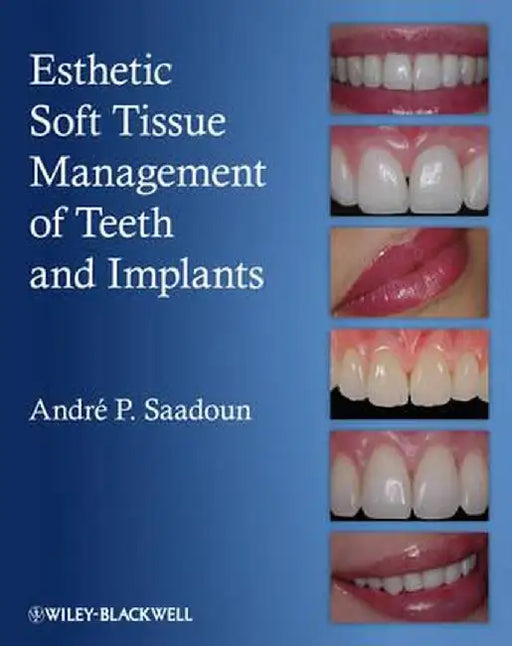 Esthetic Soft Tissue Management of Teeth and Implants by Andre P. Saadoun