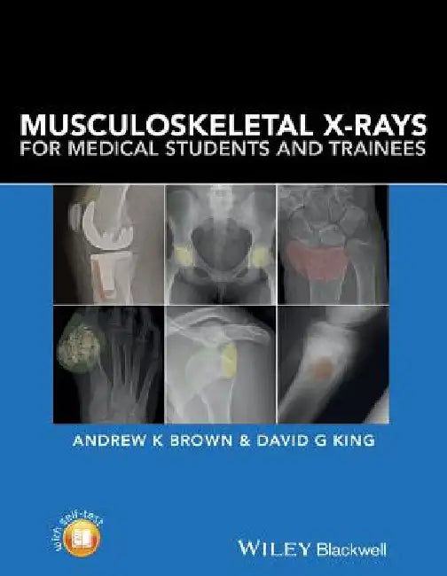 Musculoskeletal X-Rays for Medical Students and Trainees by Andrew K. Brown