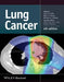 Lung Cancer by Jack A. Roth