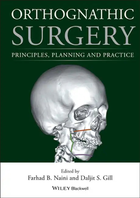 Orthognathic Surgery: Principles, Planning and Practice by Farhad B. Naini