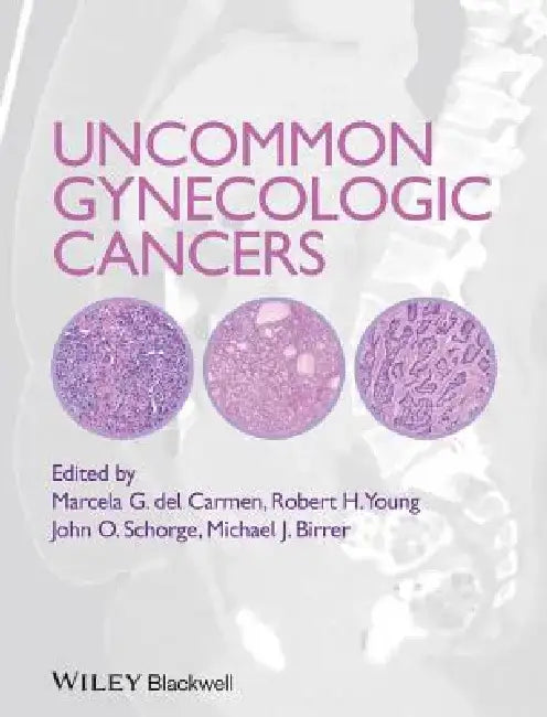 Uncommon Gynecologic Cancers by Marcela Del Carmen