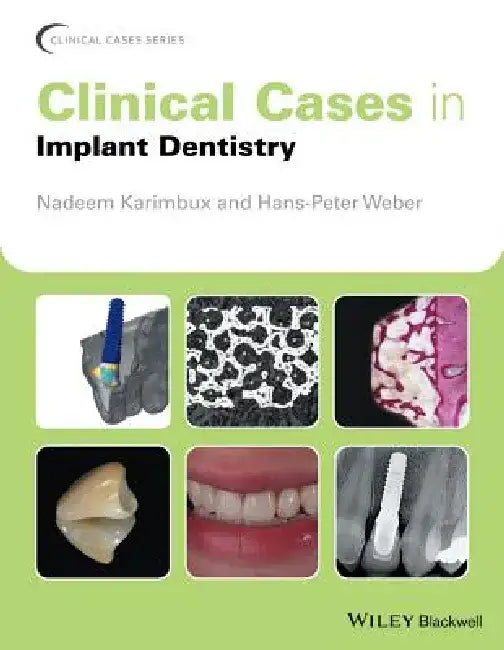Clinical Cases in Implant Dentistry by Nadeem Karimbux