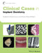 Clinical Cases in Implant Dentistry by Nadeem Karimbux