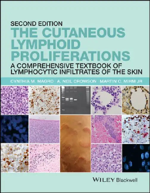 The Cutaneous Lymphoid Proliferations: A Comprehensive Textbook of Lymphocytic Infiltrates of the Skin by Cynthia M. Magro
