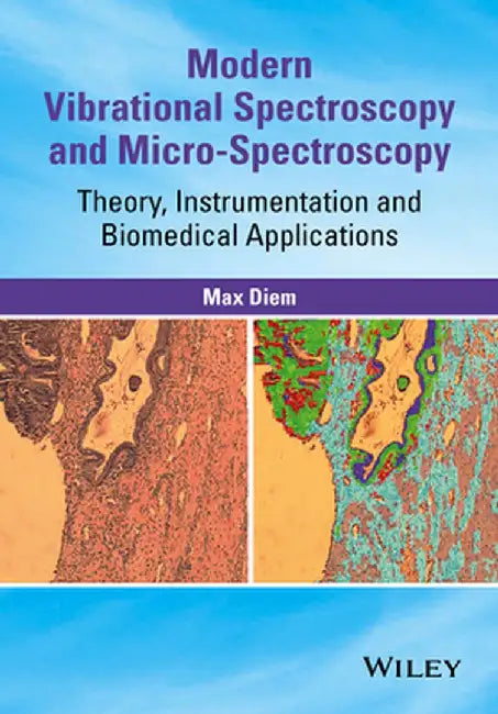 Modern Vibrational Spectroscopy and Micro-Spectroscopy: Theory, Instrumentation and Biomedical Applications by Max Diem