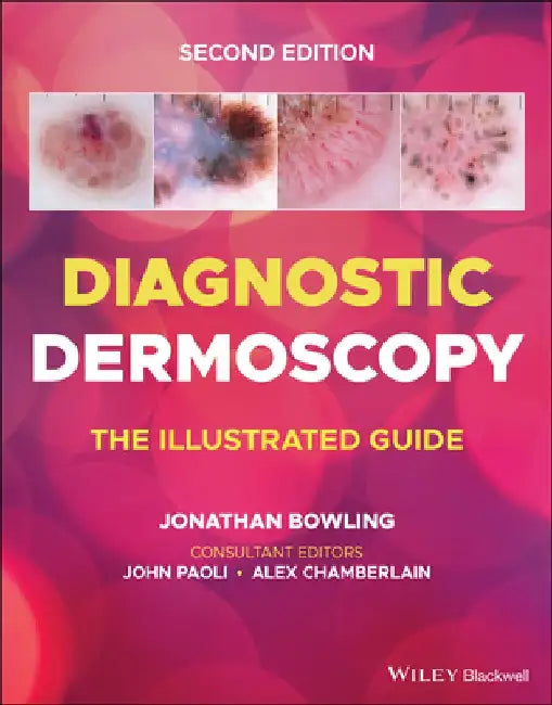 Diagnostic Dermoscopy - The Illustrated Guide by Jonathan Bowling