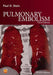 Pulmonary Embolism by Paul D. Stein
