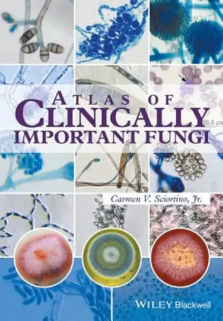 Atlas of Clinically Important Fungi by Carmen V. Sciortino