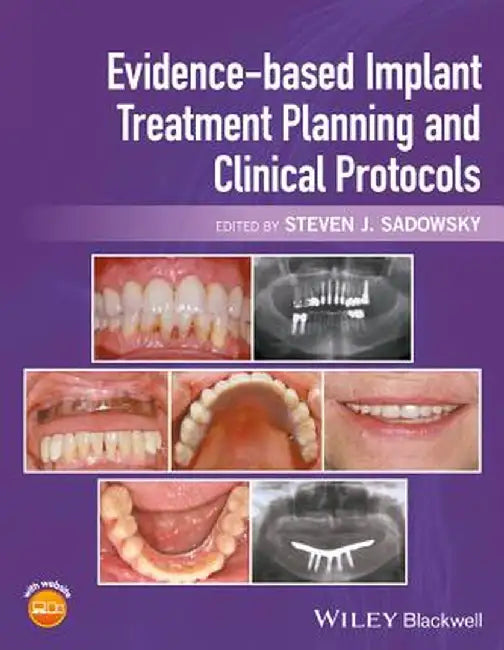 Evidence-Based Implant Treatment Planning and Clinical Protocols by Steven J. Sadowsky