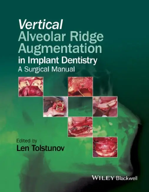 Vertical Alveolar Ridge Augmentation in Implant Dentistry: A Surgical Manual by Len Tolstunov