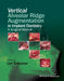 Vertical Alveolar Ridge Augmentation in Implant Dentistry: A Surgical Manual by Len Tolstunov