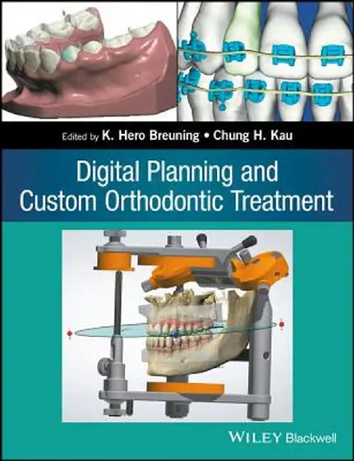 Digital Planning and Custom Orthodontic Treatment by K. Hero Breuning