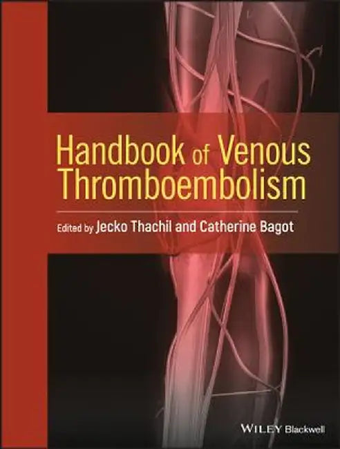 Handbook of Venous Thromboembolism by Jecko Thachil