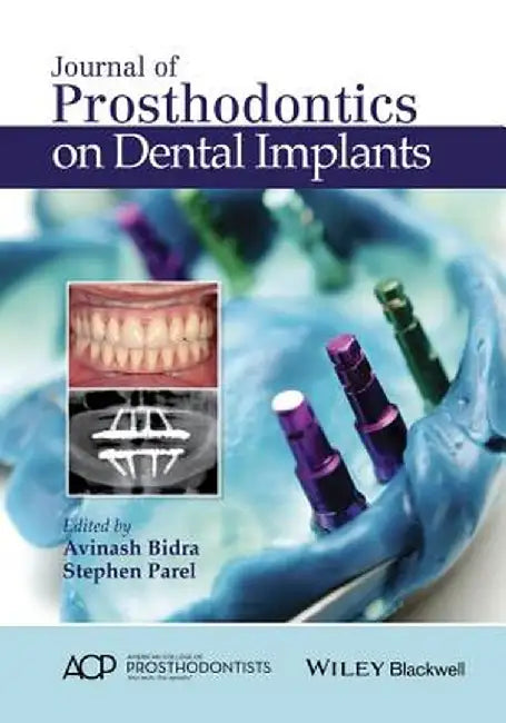 Journal of Prosthodontics on Dental Implants by Avinash Bidra