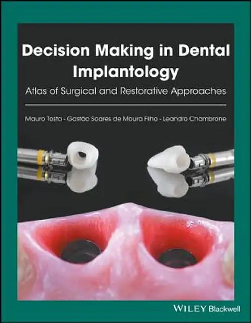 Decision Making in Dental Implantology: Atlas of Surgical and Restorative Approaches by Mauro Tosta